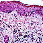 Epidermis image