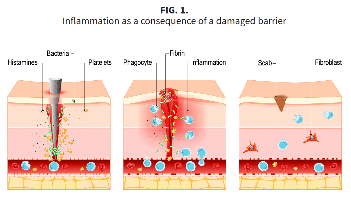 Fig-1-A2 Three stars of corneotherapy &mdash;  barrier lipids, antioxidants & hyaluronic acid