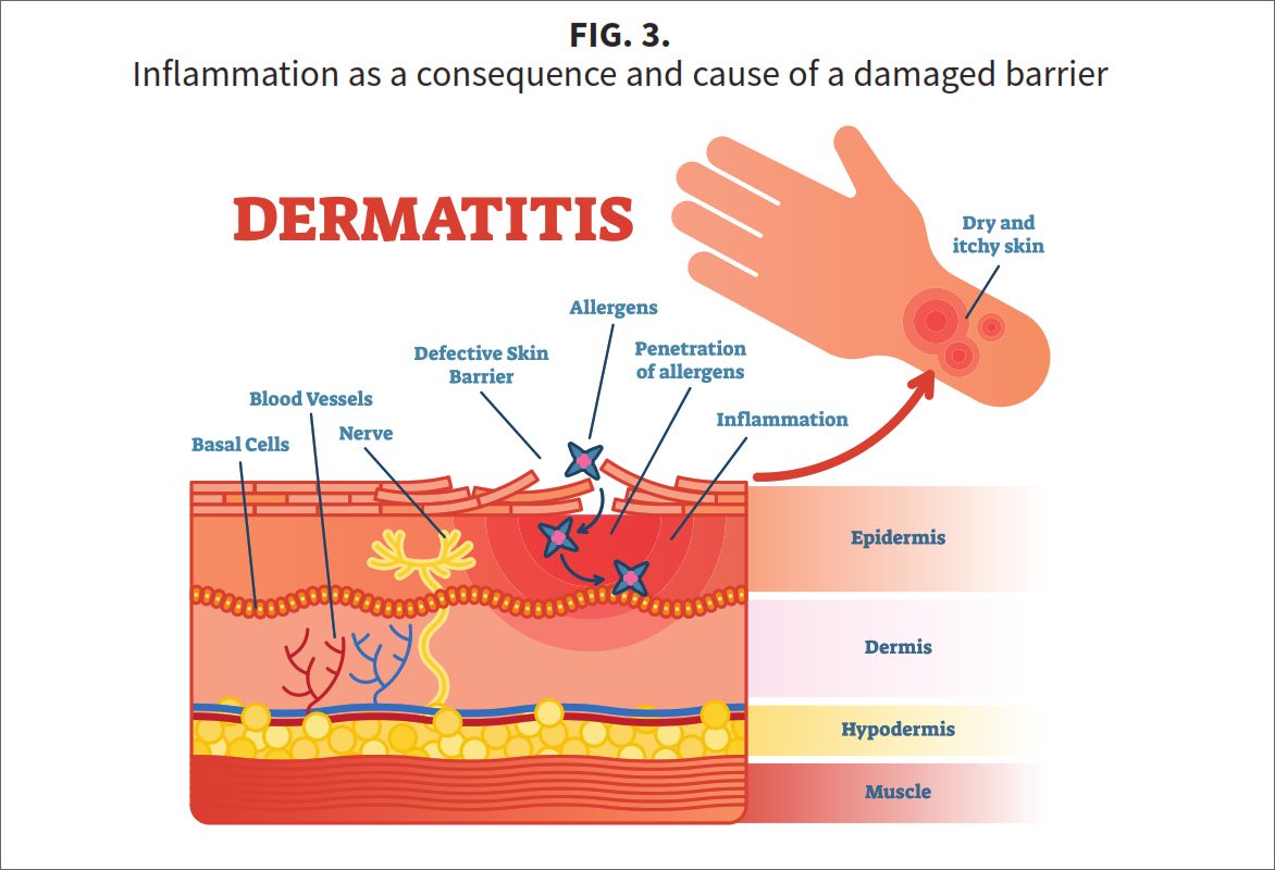 Fig-3-A2 Three stars of corneotherapy &mdash;  barrier lipids, antioxidants & hyaluronic acid