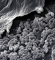 bacteria_close_185 The Anti-Inflammatory Action of Skin Microflora