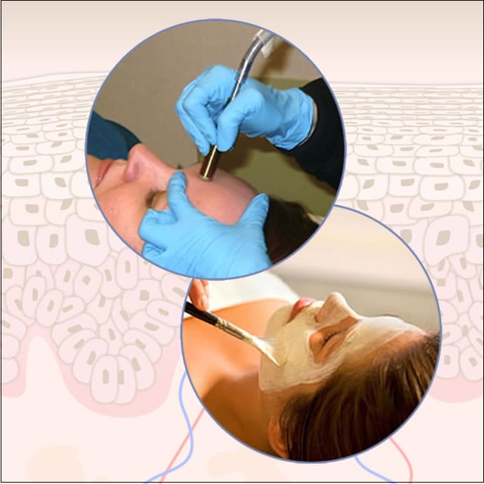 over-exfoliation The epidemic of over-exfoliation